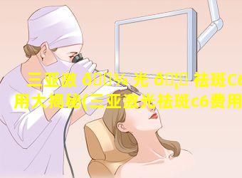 三亚激 🌾 光 🦊 祛斑C6费用大揭秘(三亚激光祛斑c6费用大揭秘)